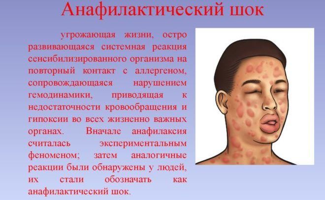 Анафилактический шок может быть как побочный эффект препарата