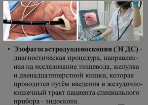 Ээзофагогастродуоденоскопия