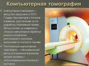 Один из методов исследования является компьютерная томография