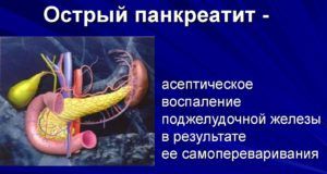 Острый панкреатит