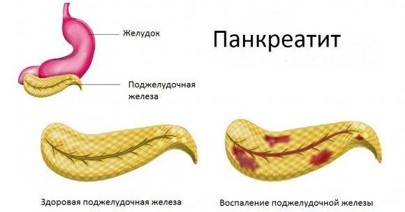 Первичная форма