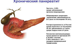 Сыр при хроническом панкреатите