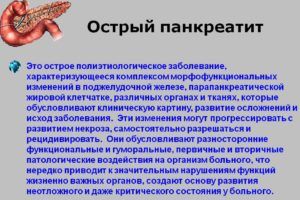 Острый панкреатит