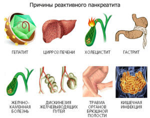 Причины