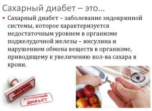 Сахарный диабет