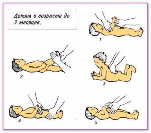 Профилактика пупочной грыжи