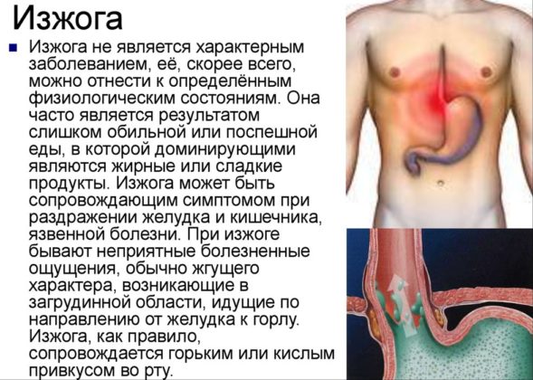 Изжога