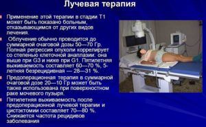 Лучевая терапия