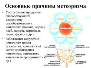 Одной из причин грыжи пищевода является метеоризм