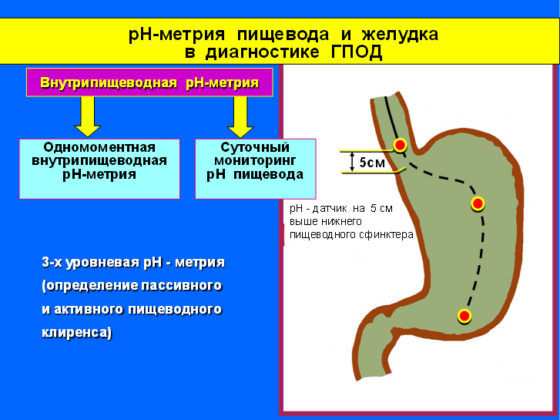 pH-метрия