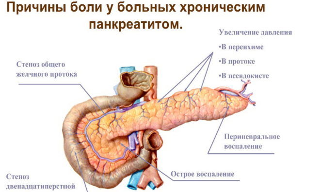 Причины развития панкреатита
